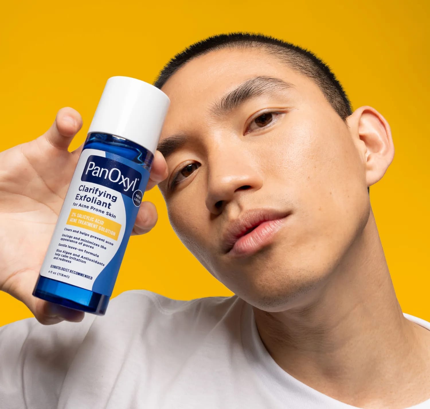 How Adapalene Stands Out Against Other Types of Retinoids